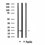 RGS10 Antibody in Western Blot (WB)