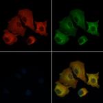 SEPT14 Polyclonal Antibody