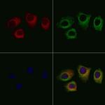 SEPT2 Polyclonal Antibody