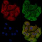 SEPT6 Antibody in Immunocytochemistry (ICC/IF)