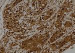STK32C Antibody in Immunohistochemistry (Paraffin) (IHC (P))