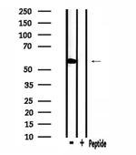 STK32C Antibody in Western Blot (WB)