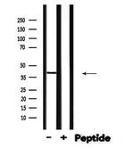 STK36 Antibody in Western Blot (WB)