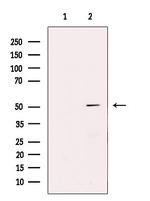 PPP2R2B Polyclonal Antibody