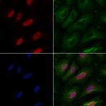 PPP2R5A Polyclonal Antibody