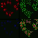 PPP2R5A Antibody in Immunocytochemistry (ICC/IF)