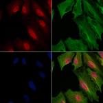 PPP4R1L Polyclonal Antibody