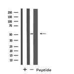 PPP4R1L Antibody in Western Blot (WB)