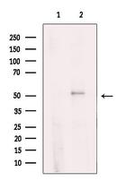 PPP4R1L Antibody in Western Blot (WB)