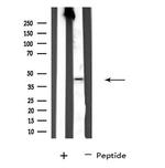 SERPINA11 Antibody in Western Blot (WB)