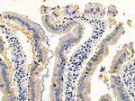 SH2D2A Polyclonal Antibody
