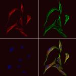 SH3GLB2 Antibody in Immunocytochemistry (ICC/IF)