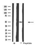 SH3GLB2 Antibody in Western Blot (WB)