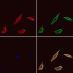 SCK Polyclonal Antibody