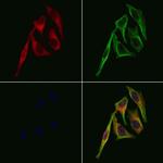 Dopamine Transporter Polyclonal Antibody