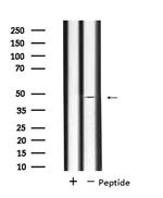 SLC17A2 Antibody in Western Blot (WB)