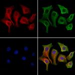 OATP2 Polyclonal Antibody