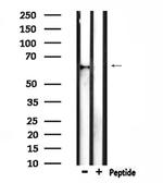 TCF7L1 Antibody in Western Blot (WB)