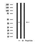 GTF3A Antibody in Western Blot (WB)