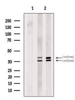 GTF3A Polyclonal Antibody