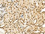 USP30 Antibody in Immunohistochemistry (Paraffin) (IHC (P))