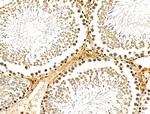 USP30 Antibody in Immunohistochemistry (Paraffin) (IHC (P))