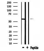 USP30 Antibody in Western Blot (WB)