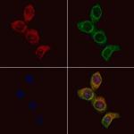 CACNG1 Polyclonal Antibody