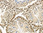 WEE2 Antibody in Immunohistochemistry (Paraffin) (IHC (P))