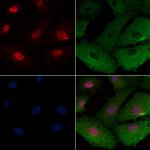 ZNF50 Polyclonal Antibody