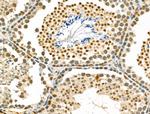 ZNF50 Antibody in Immunohistochemistry (Paraffin) (IHC (P))