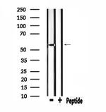 ZNF50 Antibody in Western Blot (WB)