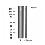 ZNF292 Antibody in Western Blot (WB)