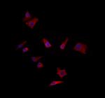 ZADH2 Polyclonal Antibody