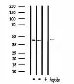ZADH2 Antibody in Western Blot (WB)