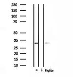 SMUG1 Polyclonal Antibody