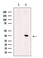 ZNF691 Polyclonal Antibody