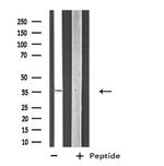 ZNF691 Antibody in Western Blot (WB)