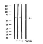 ZNF695 Antibody in Western Blot (WB)