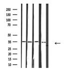 RNF113B Polyclonal Antibody