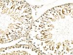 Osr2 Antibody in Immunohistochemistry (Paraffin) (IHC (P))