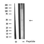 SLC38A2 Antibody in Western Blot (WB)