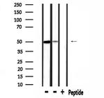 SLC38A2 Polyclonal Antibody