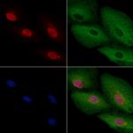 ARX Polyclonal Antibody