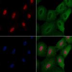ELF4 Polyclonal Antibody