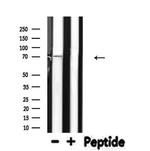 ELF4 Antibody in Western Blot (WB)