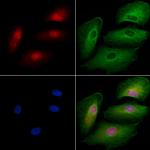 ZNF446 Polyclonal Antibody