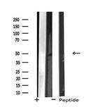 ZNF446 Antibody in Western Blot (WB)