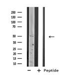 PLAGL1 Antibody in Western Blot (WB)