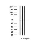 PLAGL1 Antibody in Western Blot (WB)